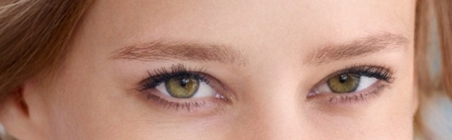 Miről árulkodnak a karikás szemek?